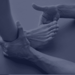 Tailor's bunion showing a bony bump on the outer side of the little toe