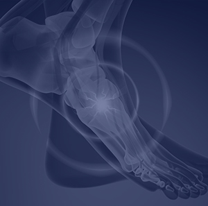 Pain on Top of Foot